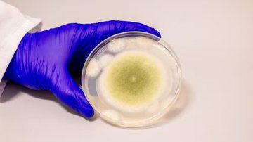 Aspergillus flavus - Divulgação/Universidade da Pensilvânia