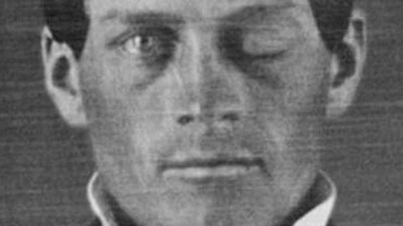Retrato de Phineas Gage - Jack e Beverly Wilgus / Warren Anatomical Museum / Harvard Medical School / Wikimedia Commons